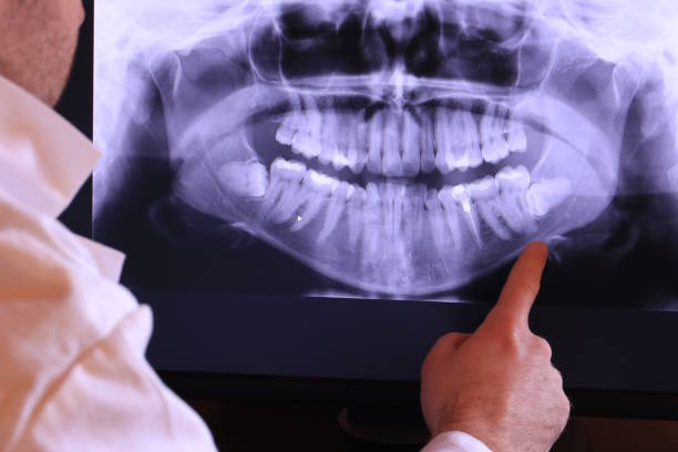 Best Emergency Treatment for Dental Infections or Abscesses in Laughlin Af, TX