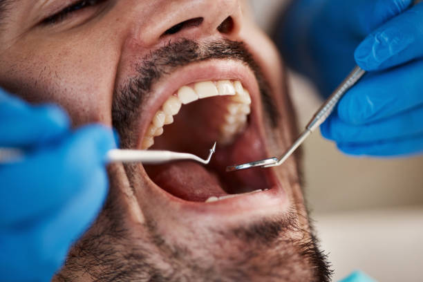 Best Emergency Root Canal Treatment in Laughlin Af, TX